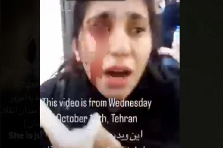 İranda qızın gözünü çıxardılar - VİDEO