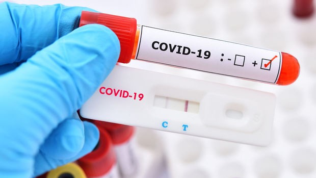 Rusiya COVID-19-a qarşı növbəti vaksini dövriyyəyə buraxdı