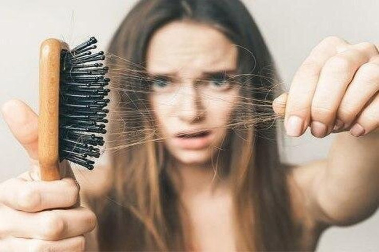 Saç tökülməsinin əsas 3 səbəbi AÇIQLANDI